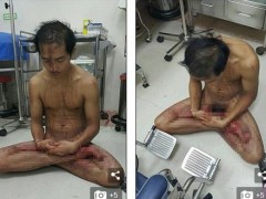 男子幻想被虐待看“重口味A片”拿刀自宫  淡定打坐还喊爽